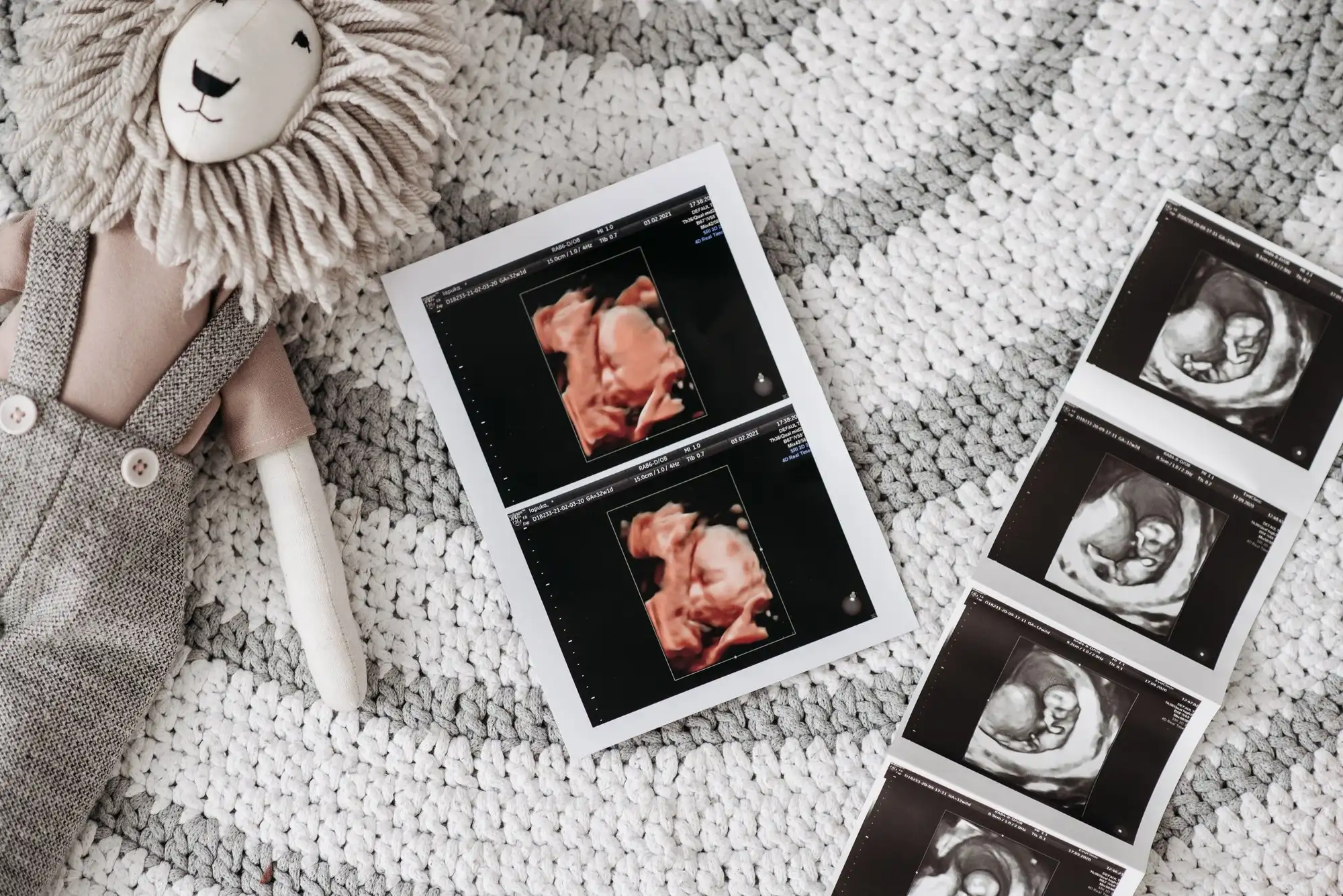 3D and 2D ultrasound prints of a baby