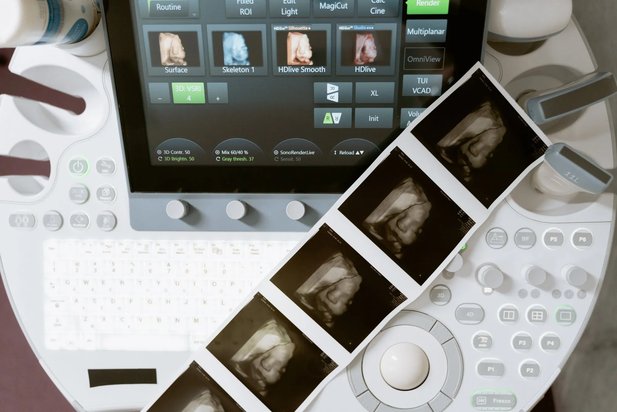 Ultrasound system showing 3D baby renderings next to a strip of printed 3D ultrasound images